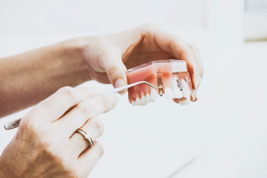 complémentaire santé implant dentaire